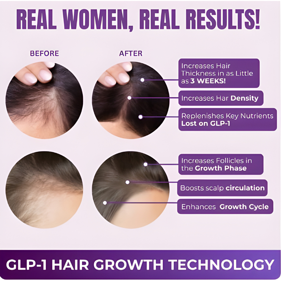 Ezura™ Hair Growth Accelerator